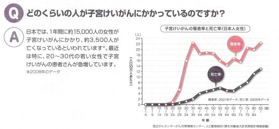 サーバリックスのパンフレット